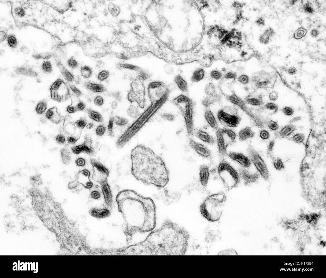 Creato da centri per il controllo e la prevenzione delle malattie (CDC) microbiologo Cynthia orafo, questo microscopio elettronico a trasmissione (TEM) ha rivelato alcuni della morfologia ultrastrutturale visualizzati da un certo numero di virus Ebola virioni. Il virus Ebola è un grave e spesso irreversibile della malattia negli esseri umani e primati non umani (scimmie, gorilla e scimpanzé) che è apparso sporadicamente sin dalla sua iniziale rilevazione in 1976. Immagine cortesia CDC/Cynthia Goldsmith. 1990. Foto Stock