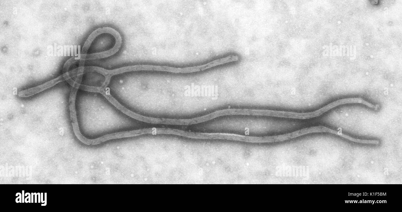 Creato da CDC microbiologo Cynthia orafo, questo microscopio elettronico a trasmissione (TEM) ha rivelato alcuni della morfologia ultrastrutturale visualizzate da un virus Ebola virione. Vedere PHIL 10816 per una versione colorato di questa immagine. Il virus Ebola è un grave e spesso irreversibile della malattia negli esseri umani e primati non umani (scimmie, gorilla e scimpanzé) che è apparso sporadicamente sin dalla sua iniziale rilevazione in 1976. Immagine cortesia CDC/Cynthia Goldsmith. 1990. Foto Stock