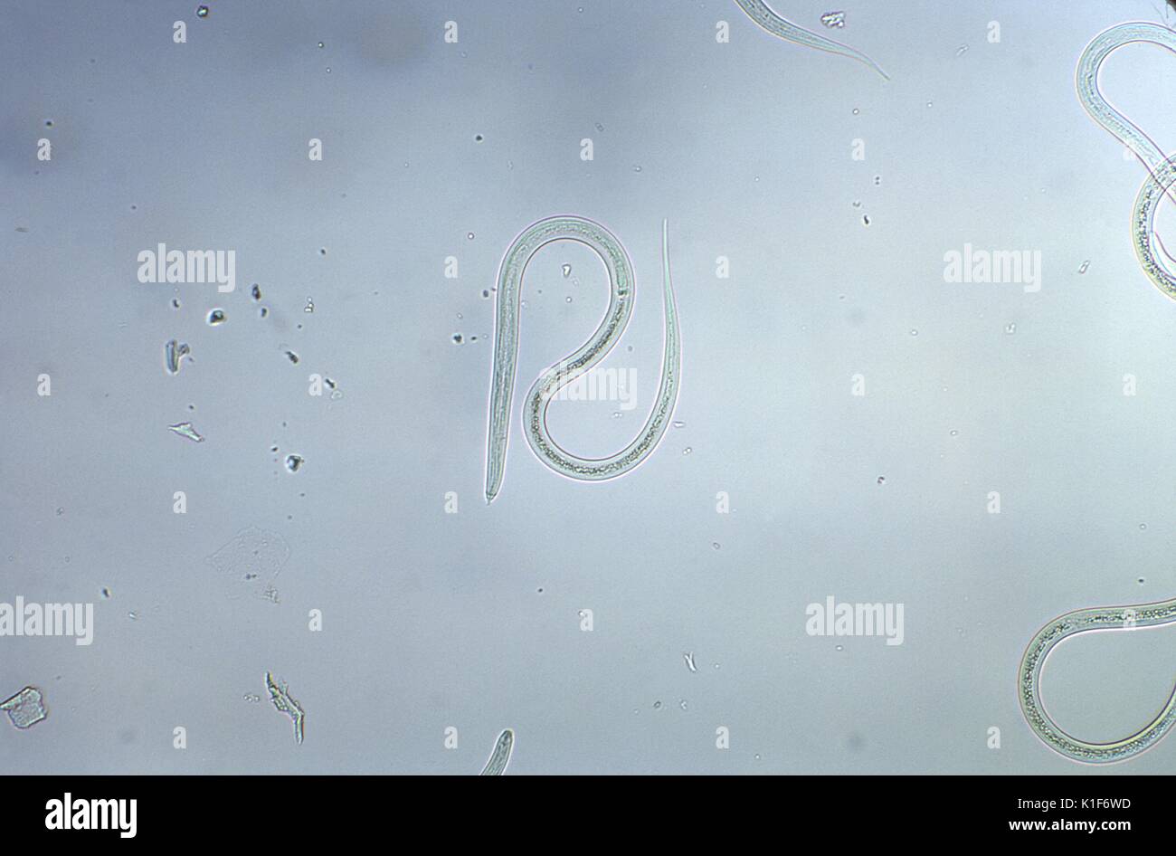 Sotto un ingrandimento di 128X, questo fotomicrografia ha rivelato la presenza di un numero di Strongyloides sp filariform-larvale in scena gli organismi. Infettiva, del terzo stadio di larve filariform (L3) di Strongyloides stercoralis sono fino a 600{micro}m. La coda è intagliata (cfr Fil 1509, sotto ingrandimento superiore), e dell'esofago di intestino rapporto è 1:1. Infettivo L3 larve sono presenti nel terreno e invadere l'ospite umano mediante diretta penetrazione della pelle. Essi possono essere trovati nei campioni respiratori durante i casi di autoinfection. <b>diagnosi di laboratorio:</b>. Immagine cortesia CDC/Dott. Mae Melvin, 1979. Foto Stock