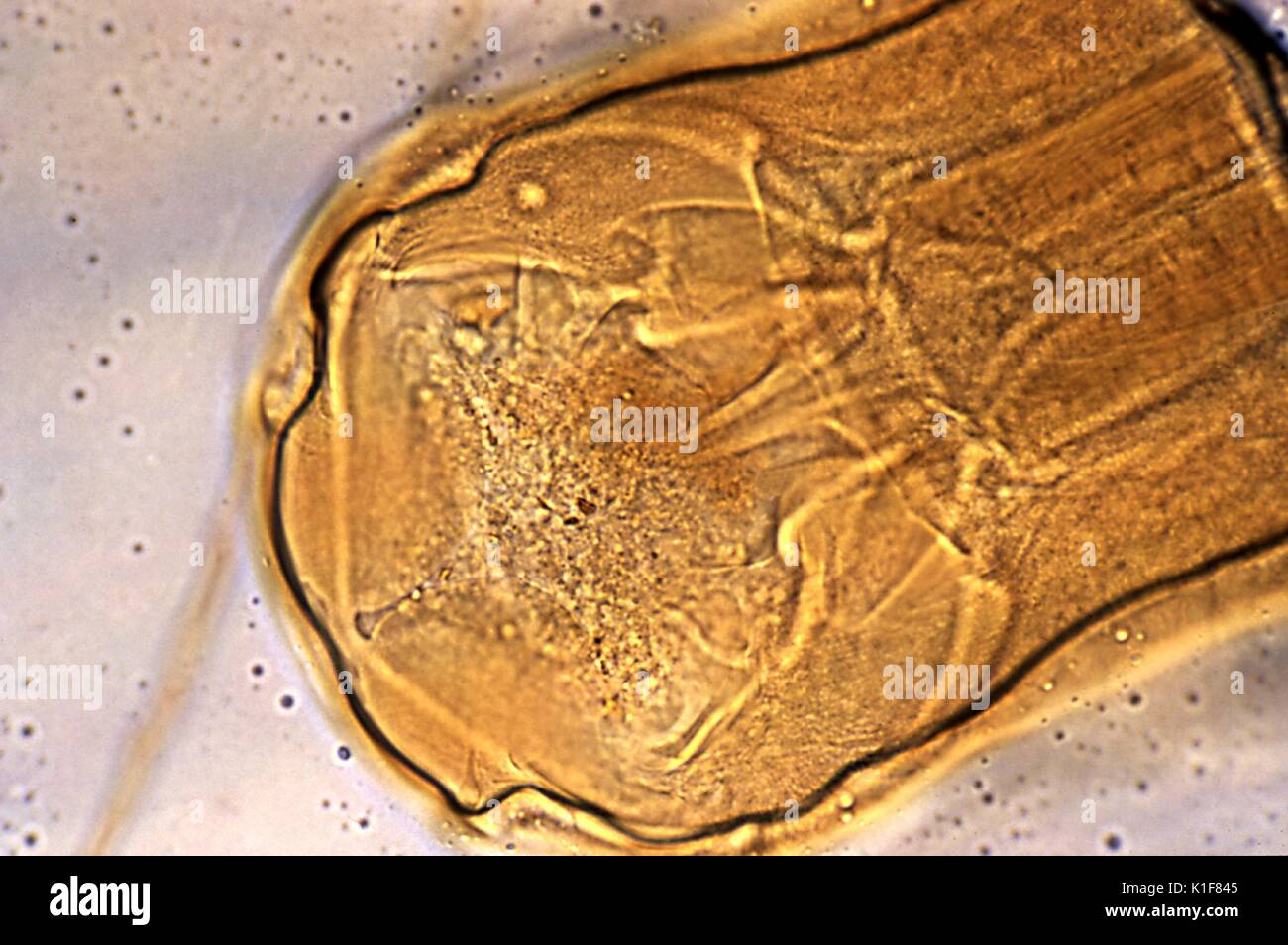 Tale micrografia rivela la testa del hookworm Necator americanus, e la sua bocca?s piatti di taglio, Mag. 400X. Il hookworm utilizza tali spigoli denti di taglio per afferrare saldamente alla parete intestinale, e pur rimanendo fissato in posto, ingerisce l'host?s sangue, ottenendo la sua nutrients in questo modo. Immagine cortesia CDC/Dott. Mae Melvin, 1982. Foto Stock