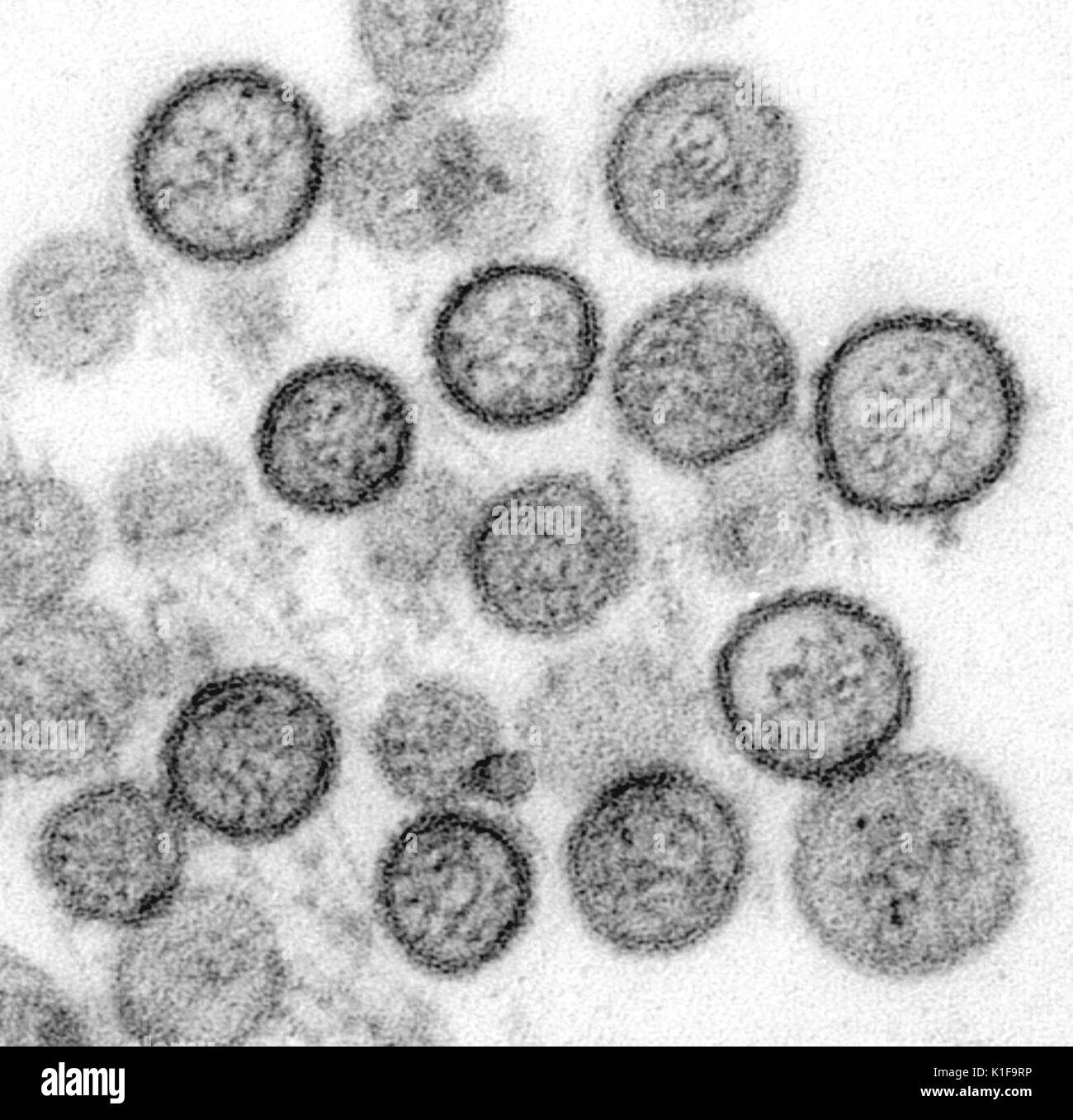 Microscopio elettronico a trasmissione di Sin Nombre virus, Hantavirus Immagine cortesia CDC/Cynthia orafo, Luanne Elliott, 1974. Foto Stock