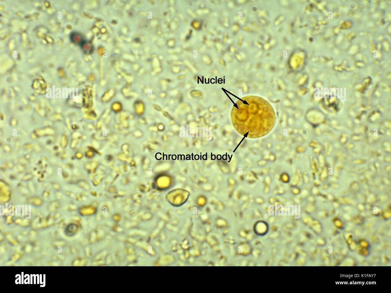 Questo iodio-colorate fotomicrografia rivelato ultrastrutturali morfologia presentata da un binucleated cisti di un Entamoeba histolytica ameba parassita in un concentrato di montaggio umido. Notare il corpo chromatoid con blunt, le estremità arrotondate e solo due nuclei sono visibili in questo piano focale. Coppia Entamoeba histolytica cisti hanno 4 nuclei che caratteristicamente hanno localizzato centralmente e karyosomes e belle, uniformemente distribuiti cromatina periferica. Le cisti di solito misura 12 a 15 {micro}m. Immagine cortesia CDC/Dott. Mae Melvin, 1977. Foto Stock
