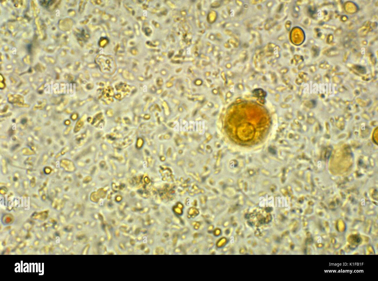 Questo fotomicrografia raffigura una ciste di un Entamoeba histolytica