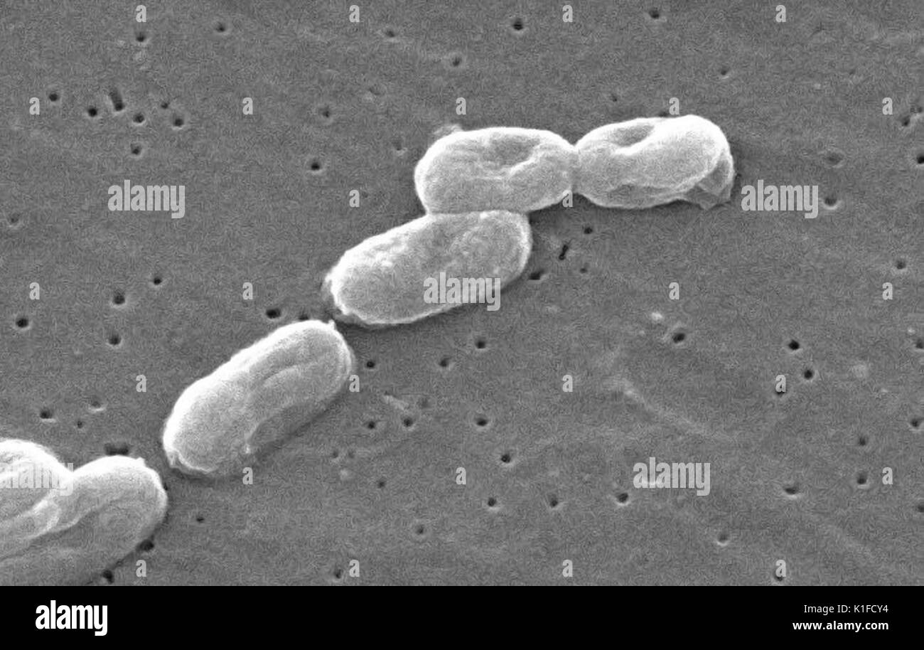 Micrografia elettronica a scansione di Burkholderia cepacia . Vedere PHIL 10608 per una versione colorato di questa immagine. Micrografia elettronica a scansione di Burkholderia cepacia. Immagine cortesia CDC/Janice Haney Carr. 1982. Foto Stock