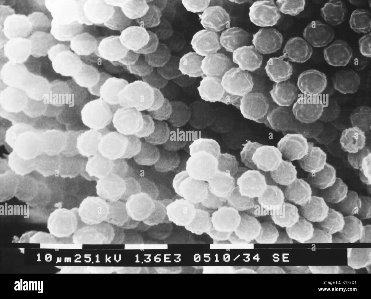 Questo scanning electron microfotografia (SEM) raffigura numero di catene di specie Aspergillus conidiospores fungina. Per una versione colorato di questa immagine, vedere PHIL 13368. Aspergillus è un fungo (o) dello stampo che è molto comune nell'ambiente. Si è trovato in suolo, sulle piante e nel decadimento di materia vegetale. Si è anche trovato nella polvere domestica, materiali da costruzione e anche nelle spezie e alcuni cibi. Ci sono un sacco di tipi diversi di Aspergillus, ma i più comuni sono quelle di Aspergillus fumigatus e Aspergillus flavus . Alcuni altri sono Aspergillus terreus, Aspergillus nidulans e Aspergillus nig Foto Stock