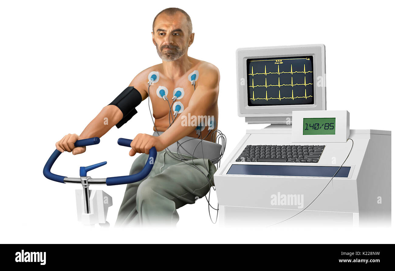 Test che misura l'attività elettrica del cuore durante i periodi di sforzo fisico. Foto Stock