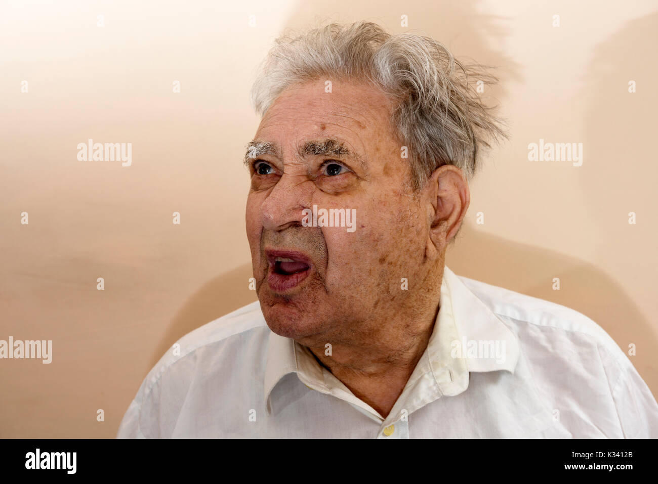 87-anno vecchio con diabete di tipo 2 Foto Stock