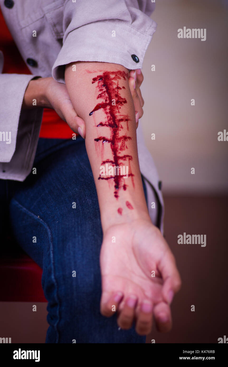 In prossimità di una giovane donna depressiva con il suo braccio lo spurgo in uno sfondo sfocato Foto Stock