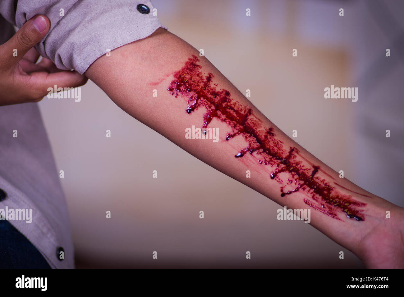 In prossimità di una giovane donna depressiva con il suo braccio lo spurgo in uno sfondo sfocato Foto Stock
