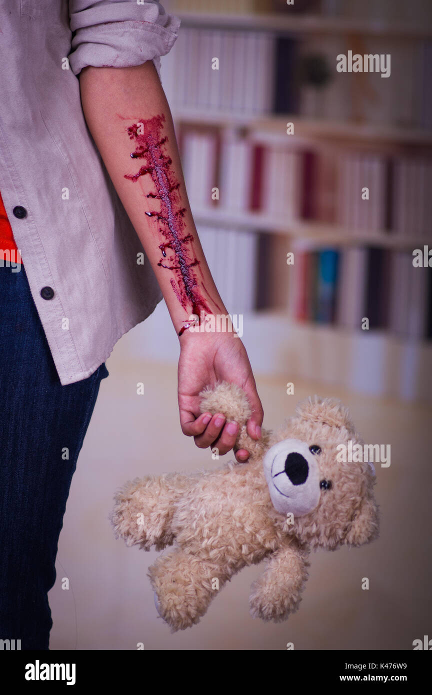 In prossimità di una giovane donna depressiva con il suo braccio lo spurgo, tenendo in mano un orsacchiotto di peluche, in uno sfondo sfocato Foto Stock