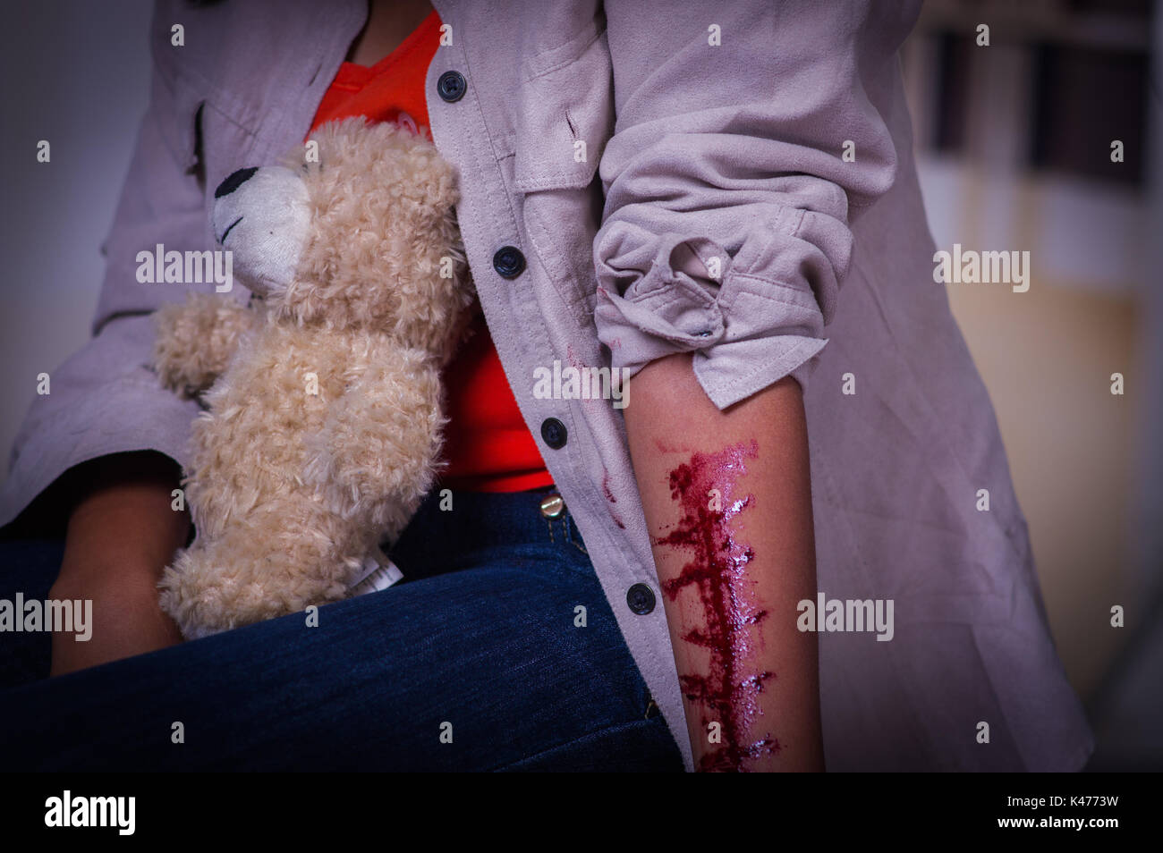 In prossimità di una giovane donna depressiva con il suo braccio lo spurgo, con un orsacchiotto di peluche nelle gambe, in uno sfondo sfocato Foto Stock