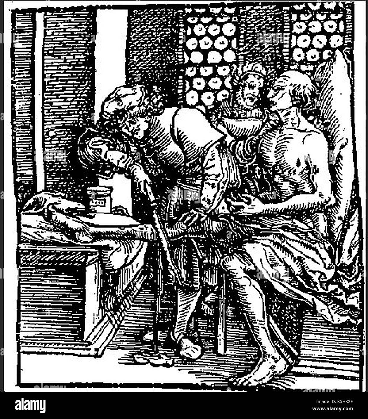 Una xilografia medievale che mostra l'amputazione di un uomo è la gamba con un laccio emostatico e una sega Foto Stock