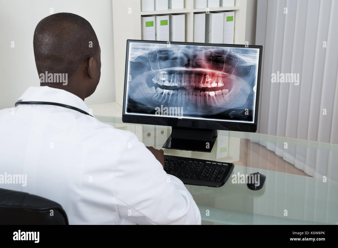 Giovane africana dentista guardando a denti x-ray sul computer alla reception Foto Stock