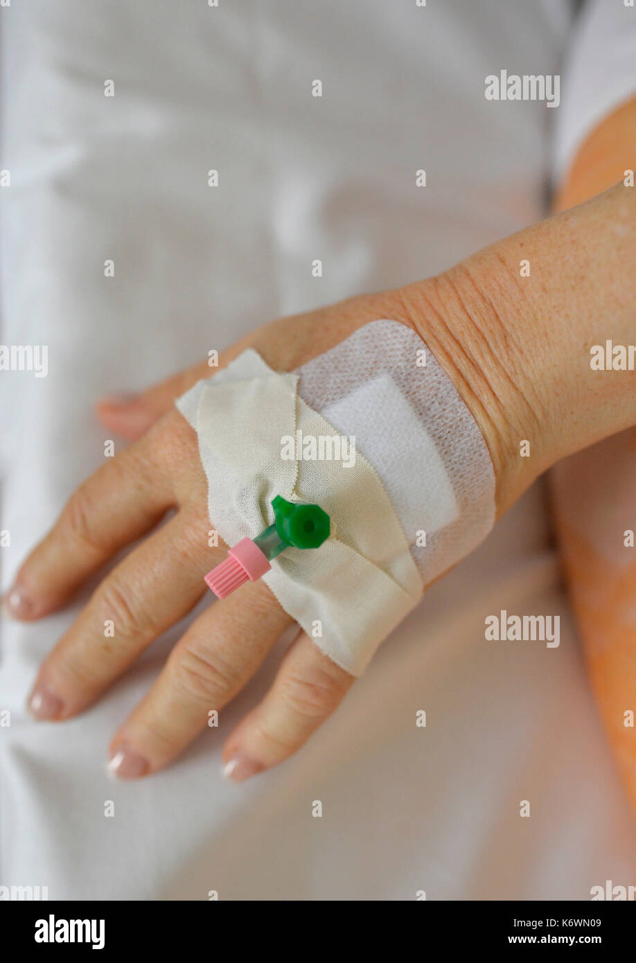 Ago per infusione, estrazione del sangue in corrispondenza del dorso della mano, Germania Foto Stock