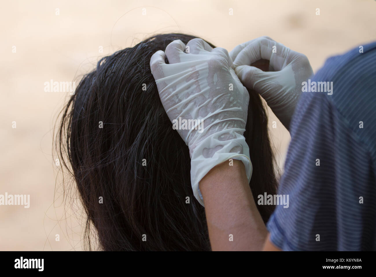 La madre viene drogato per uccidere pidocchi figlia, apparecchiature di medicina e il concetto di salute Foto Stock