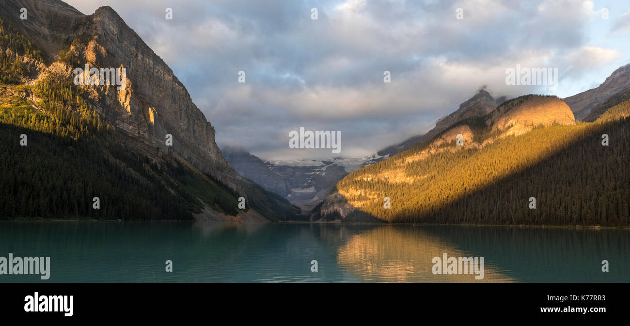 Sunrise e alpenglow, Lago Louise, il parco nazionale di Banff, Alberta, Canada Foto Stock