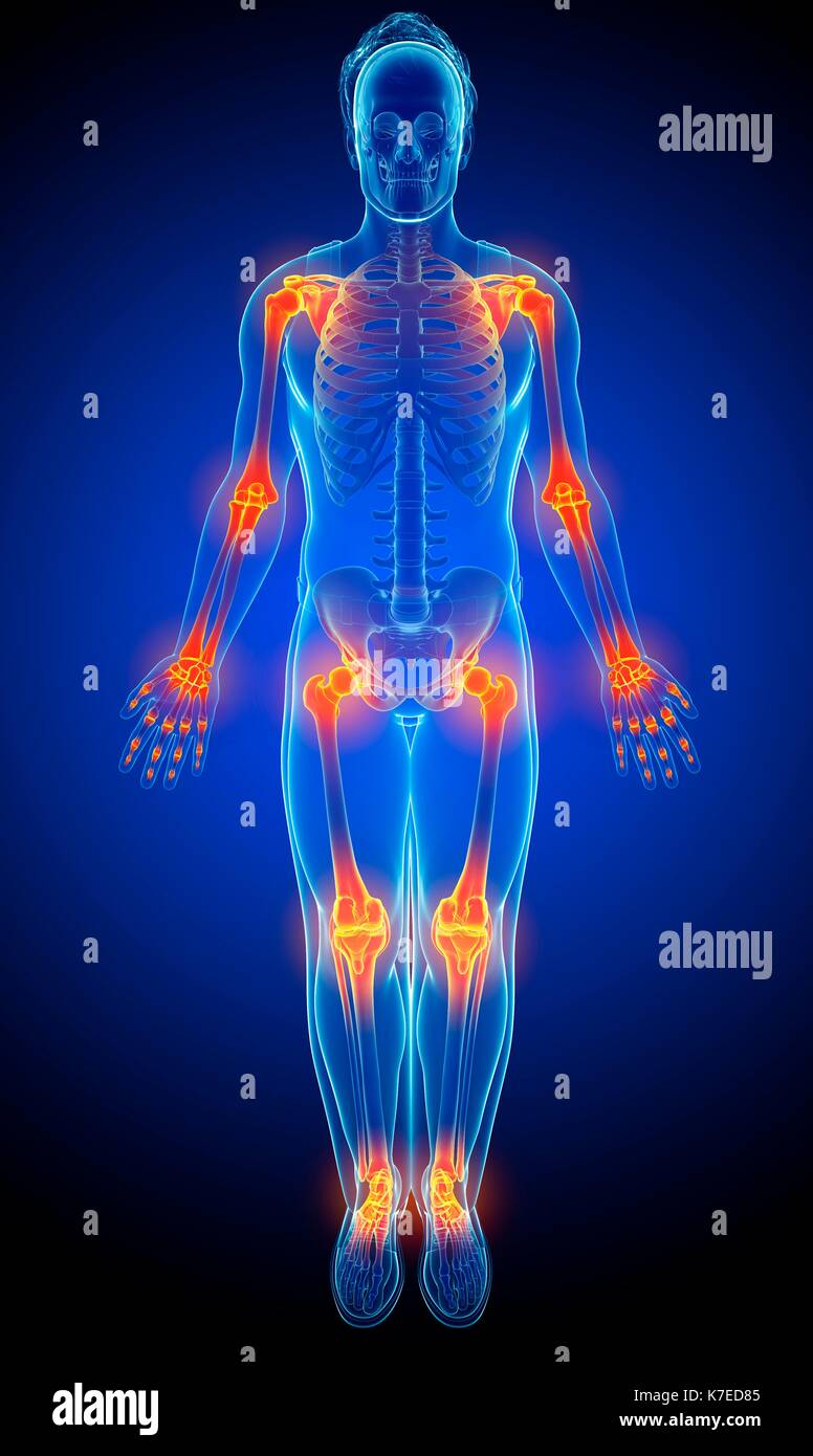 Illustrazione del giunto maschio dolore. Foto Stock