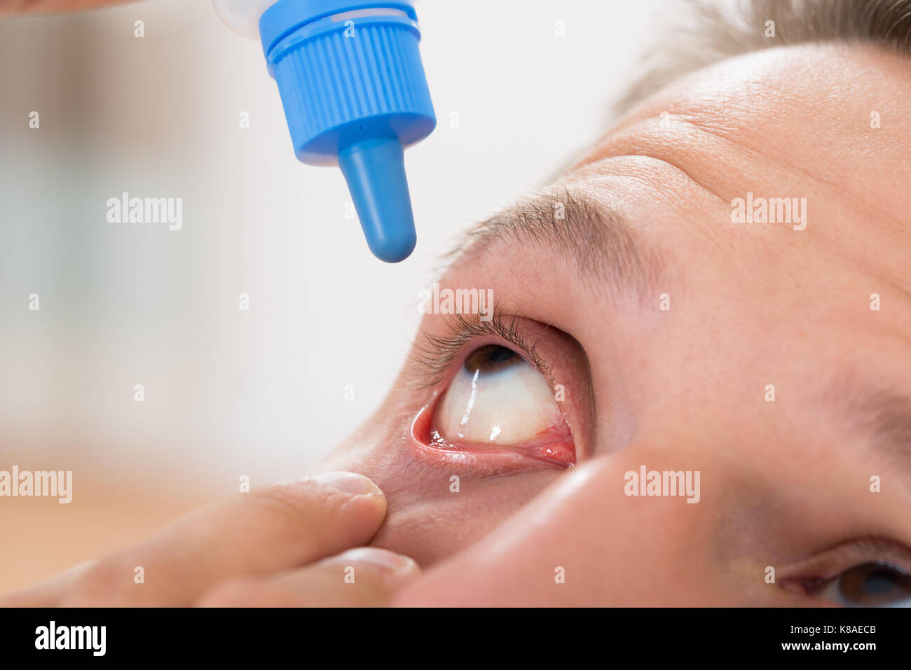 Close-up di giovane uomo versando gocce di medicina nei suoi occhi Foto Stock