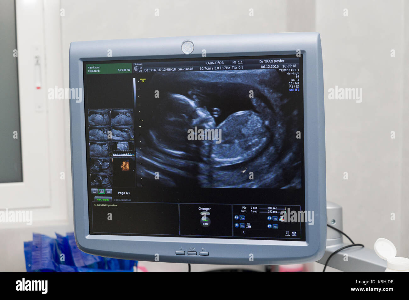 Donna incinta, ultrasuoni Foto Stock