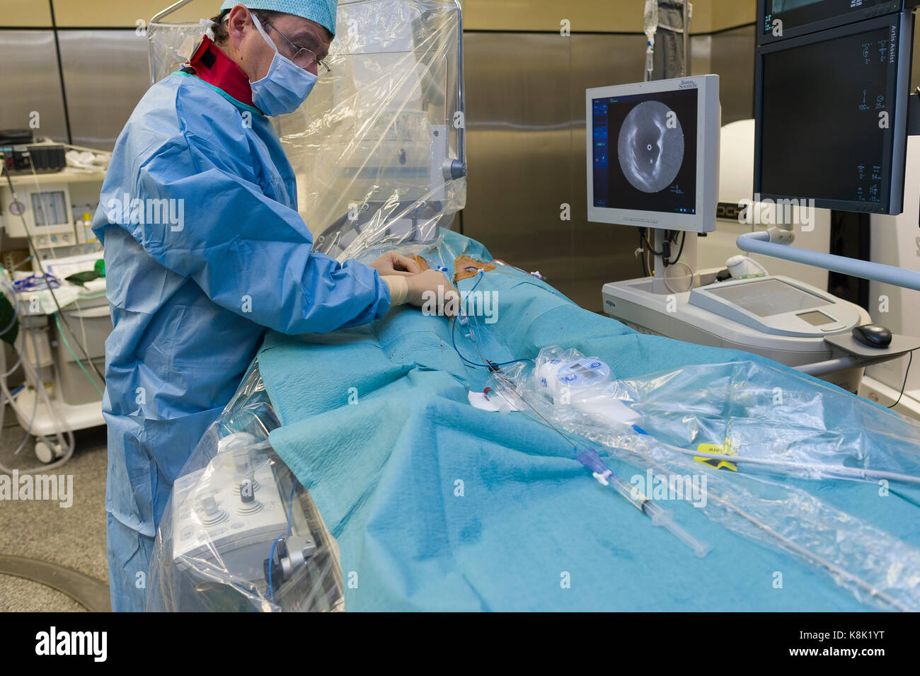 Ablazione a radiofrequenza Foto Stock