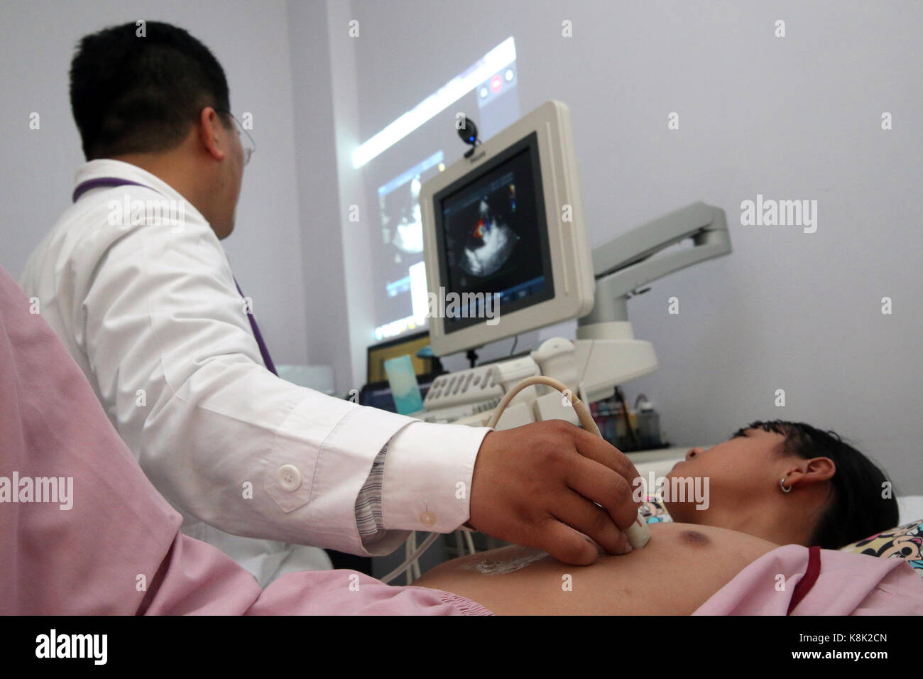 Duc Tam heart hospital. ecocardiogramma doppler. Ho chi minh city. Vietnam. Foto Stock