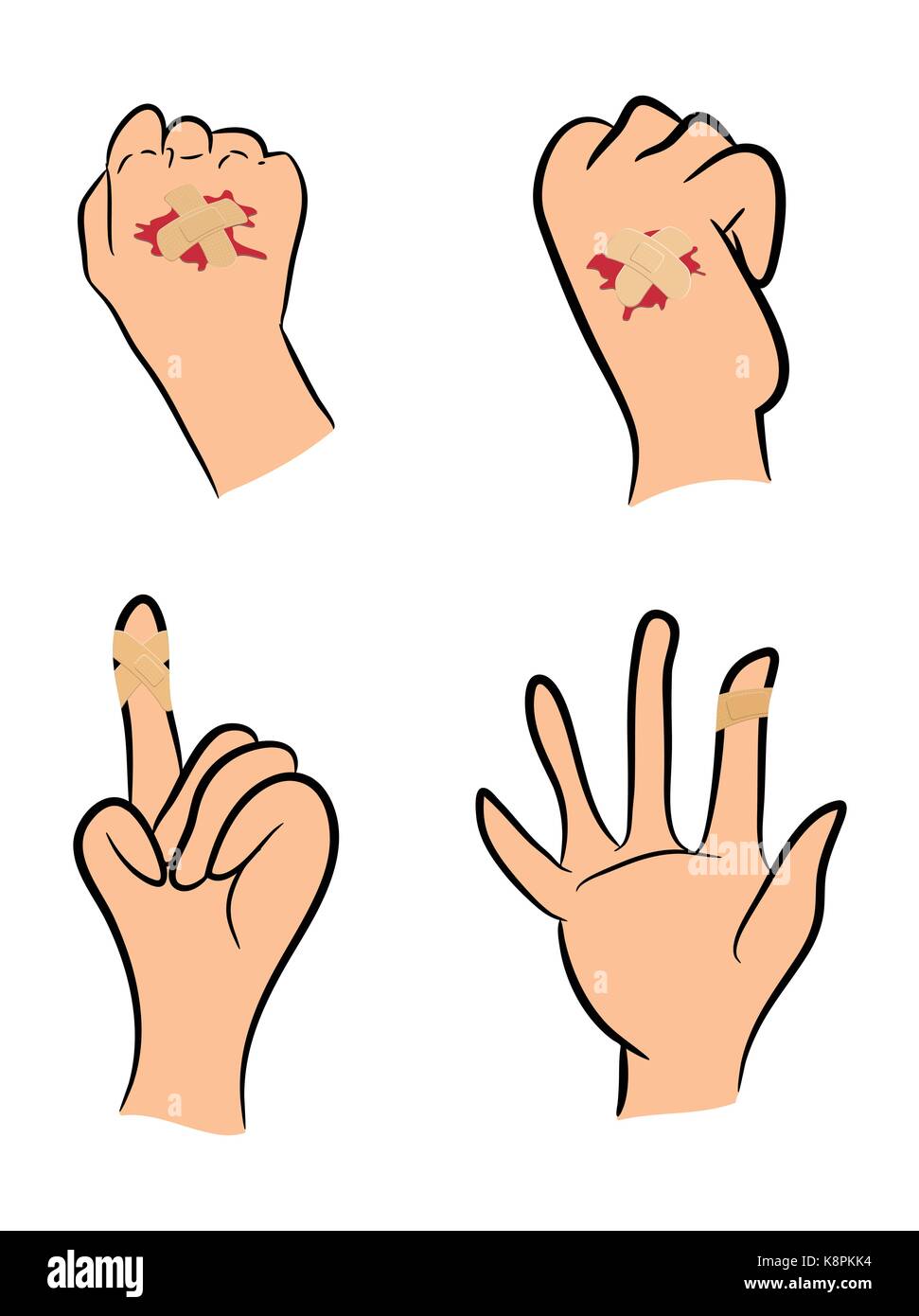 Set di feriti il dito e la mano con un cerotto adesivo rosso e pozza di sangue. Illustrazione di vettore isolato su sfondo bianco. Illustrazione Vettoriale