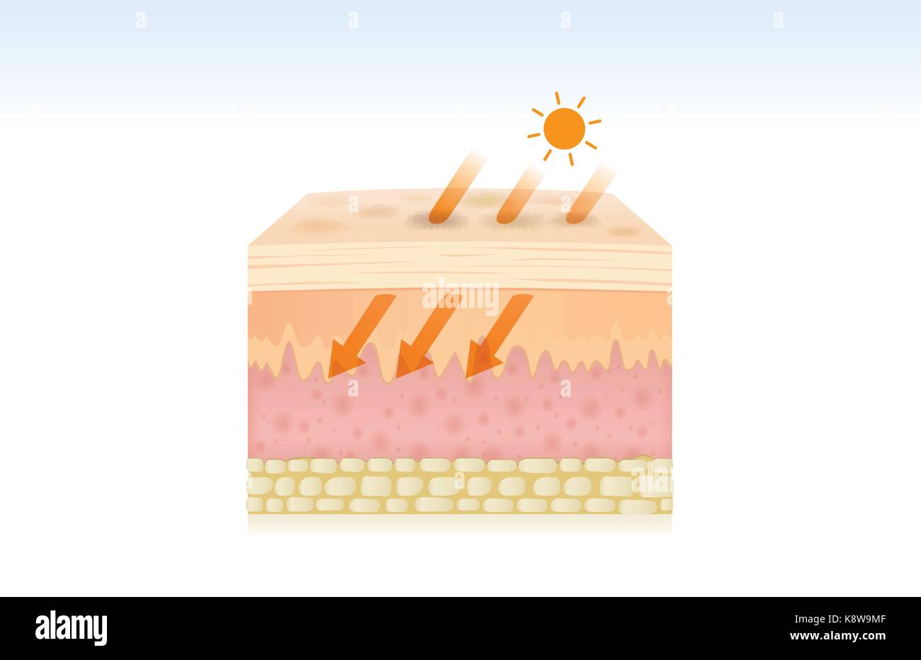 Pelle danneggiata dai raggi UV. Illustrazione Vettoriale