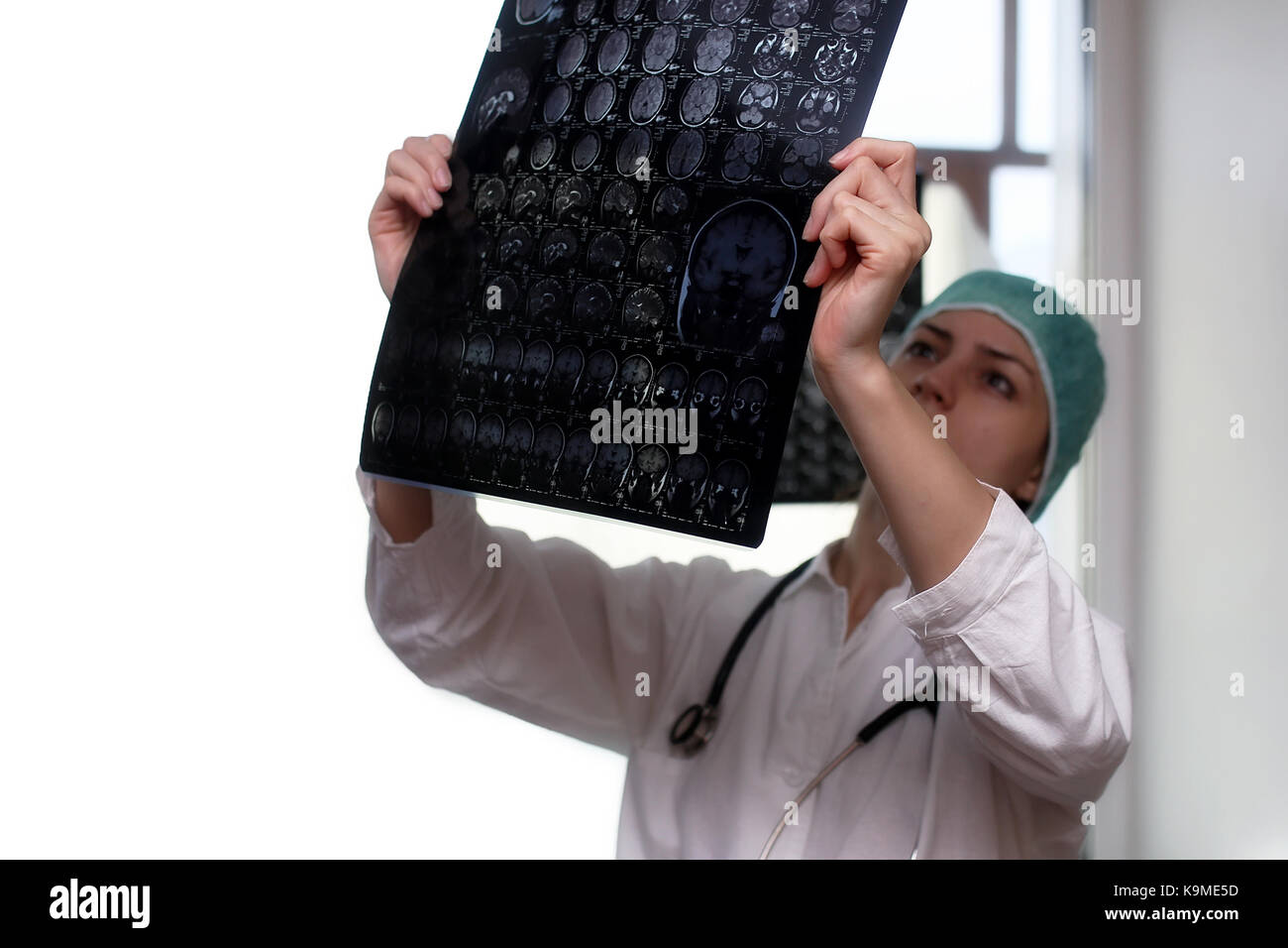 Medico in possesso di una immagine di una risonanza magnetica cerebrale Foto Stock