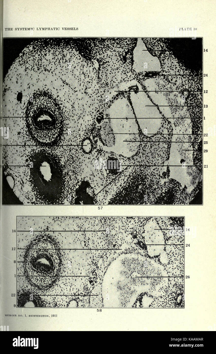 L'anatomia e sviluppo di la somministrazione sistemica di vasi linfatici nel gatto domestico BHL23322346 Foto Stock