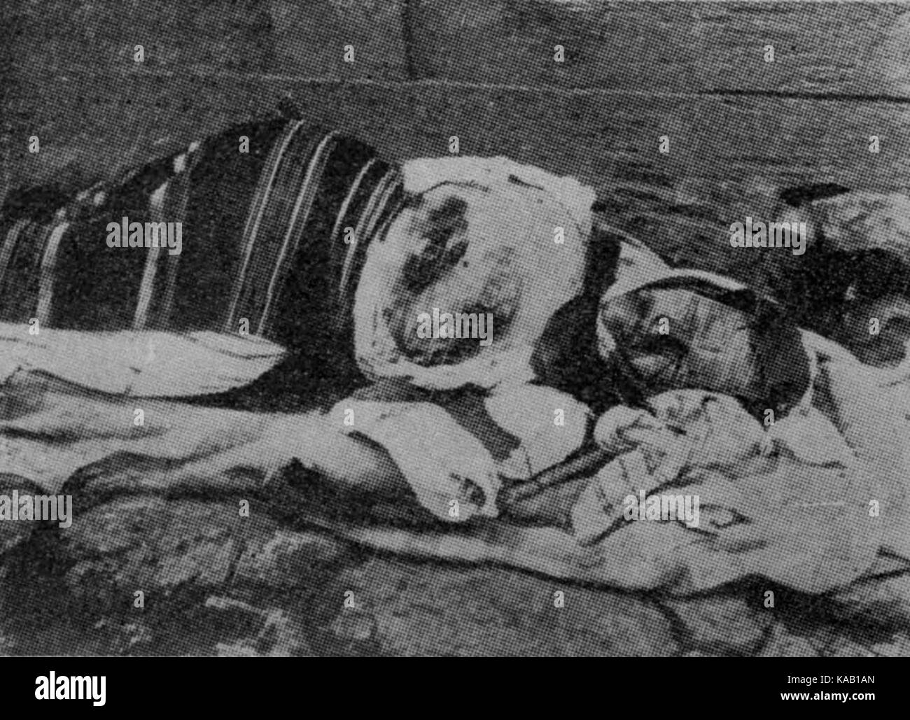 Il serbo contadina mutilata Foto Stock