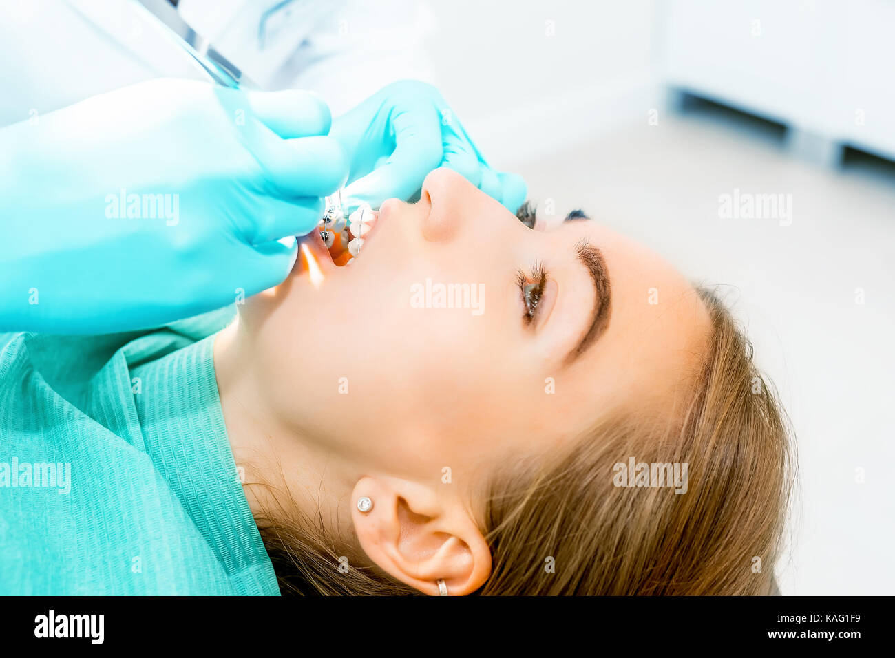 Dentista femmina a controllare i denti del paziente con le bretelle a dental clinic office. medicina e odontoiatria concetto. apparecchiature dentali. close up. Foto Stock