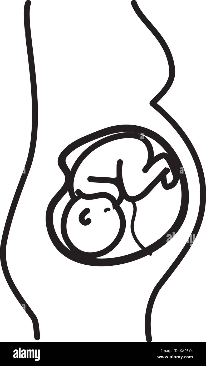 La linea donna aspettano e baby con cordone ombelicale Illustrazione Vettoriale