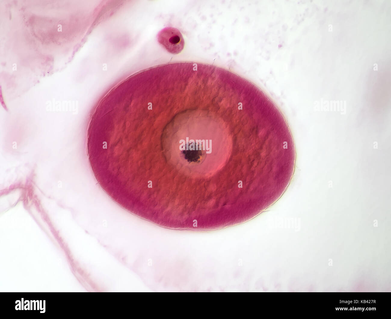 Campo luminoso micrografia di luce di un acqua macchiata flea (Daphnia sp.) uovo Foto Stock