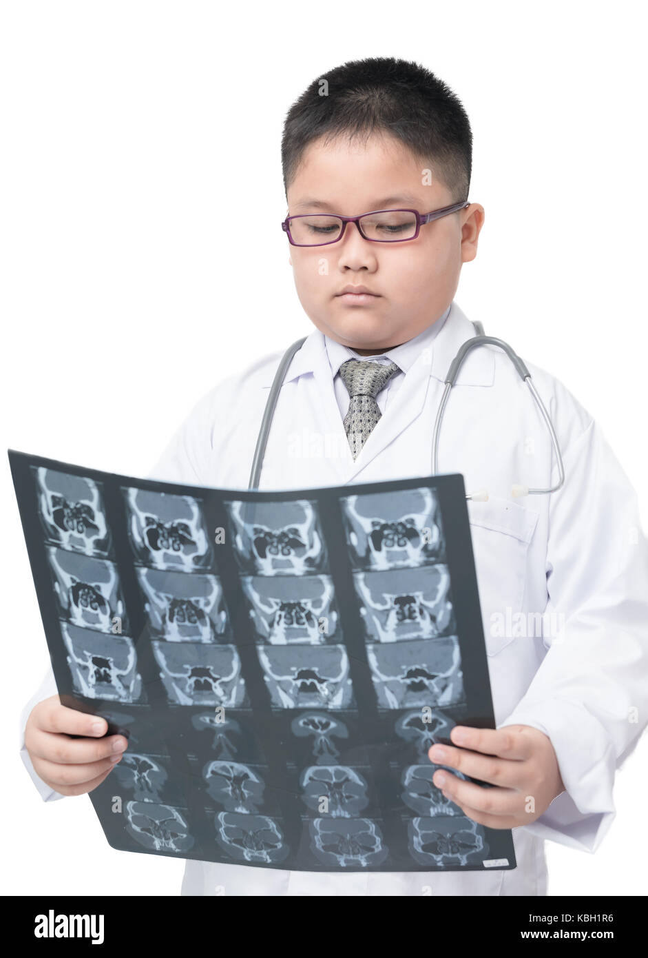 Ragazzo obesi medico controllare la pellicola a raggi x isolato su sfondo bianco, health care concept Foto Stock