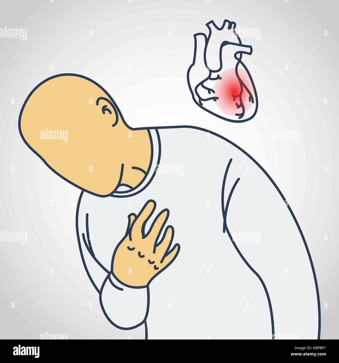 La malattia delle arterie coronarie icona vettore illustrazione Illustrazione Vettoriale