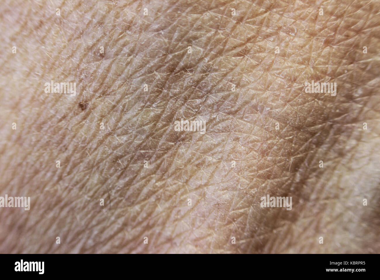 Ruvida la pelle secca sulla mano dopo un bagno di sole e vena blu Foto  stock - Alamy