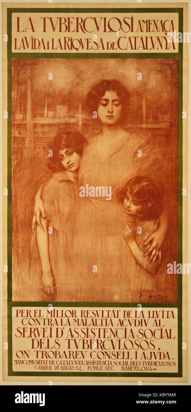 Casas tuberculosi 4281 Foto Stock