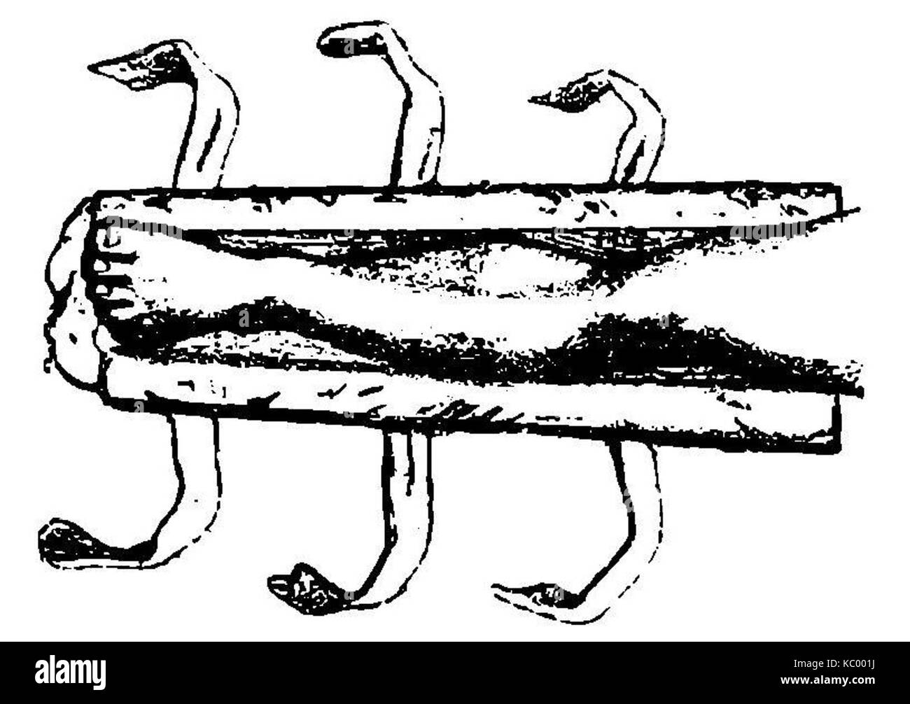 *Grierson 52 Vendaje para fractura de la pierna* è un'illustrazione medica che mostra una tecnica di bendaggio di frattura della gamba. Rappresenta un metodo storico per il trattamento degli arti rotti. Foto Stock