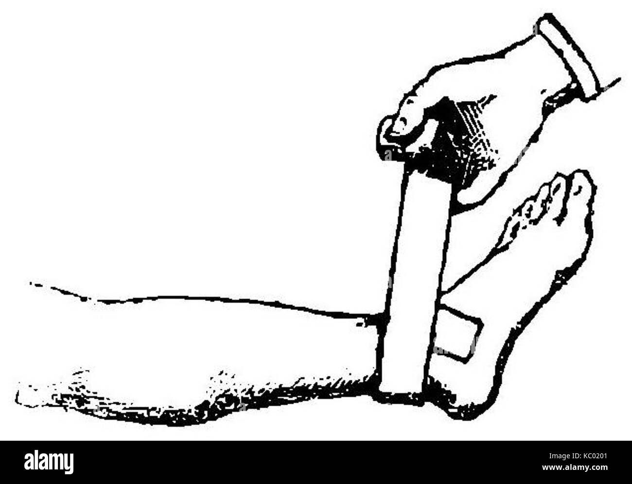 Grierson 88 Vendaje en tobillo Foto Stock