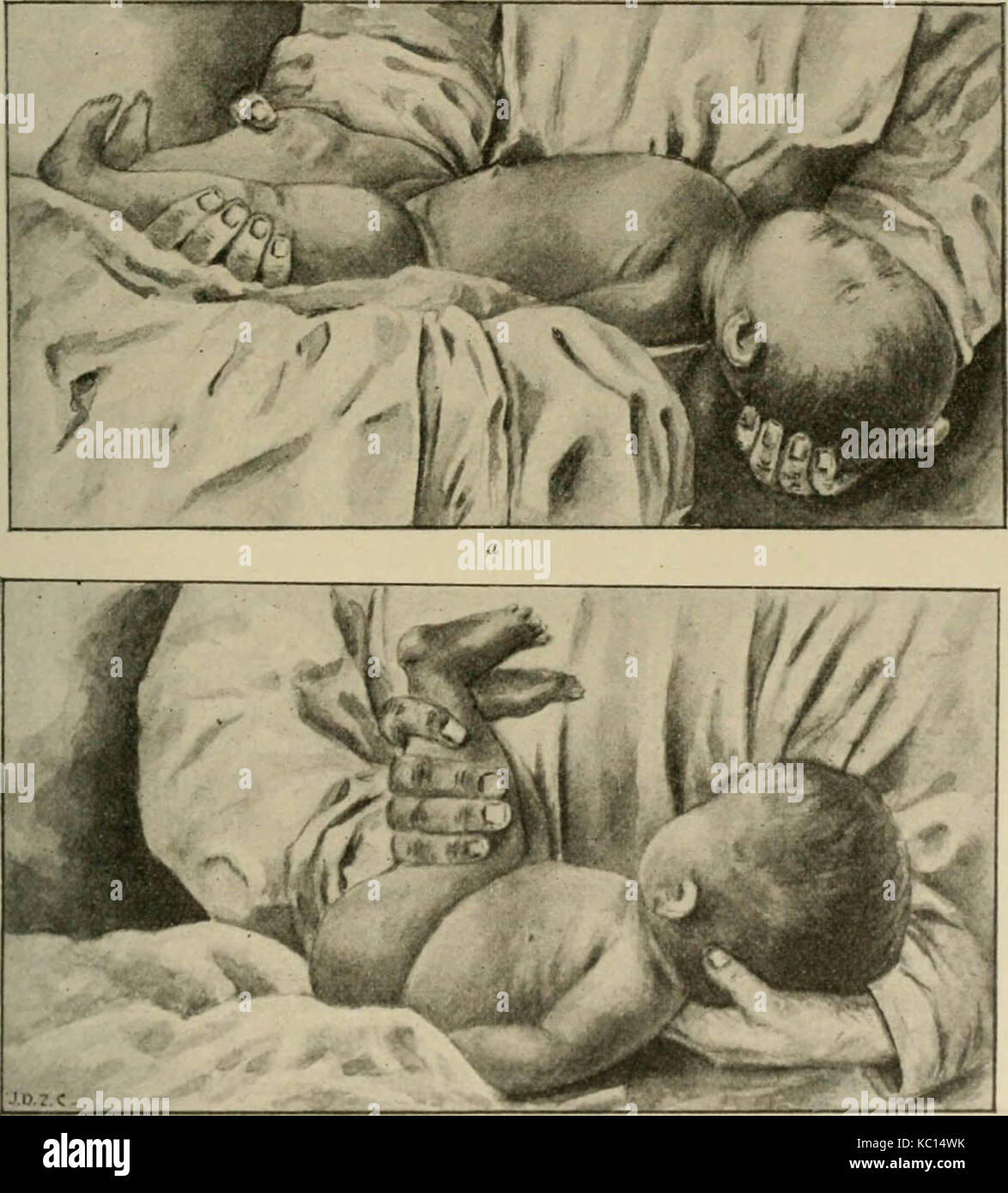 "Le malattie dei neonati e dei bambini" (1919) Foto Stock
