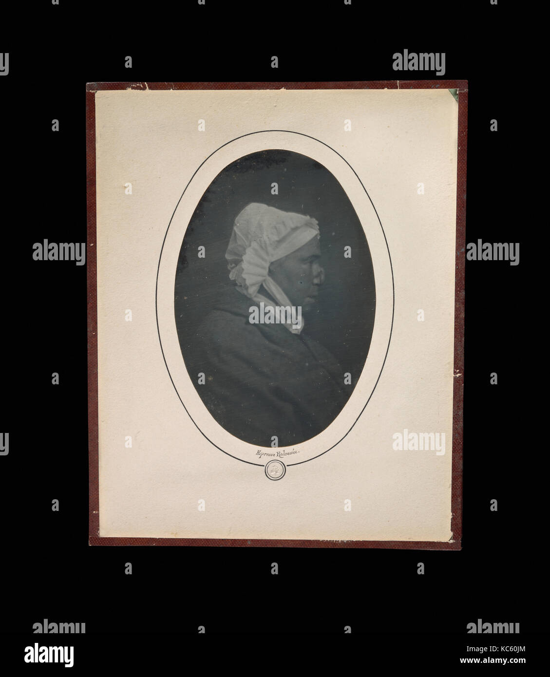 Profilo di una donna con la necrosi del naso, Louis-Auguste Bisson, 1841-48 Foto Stock