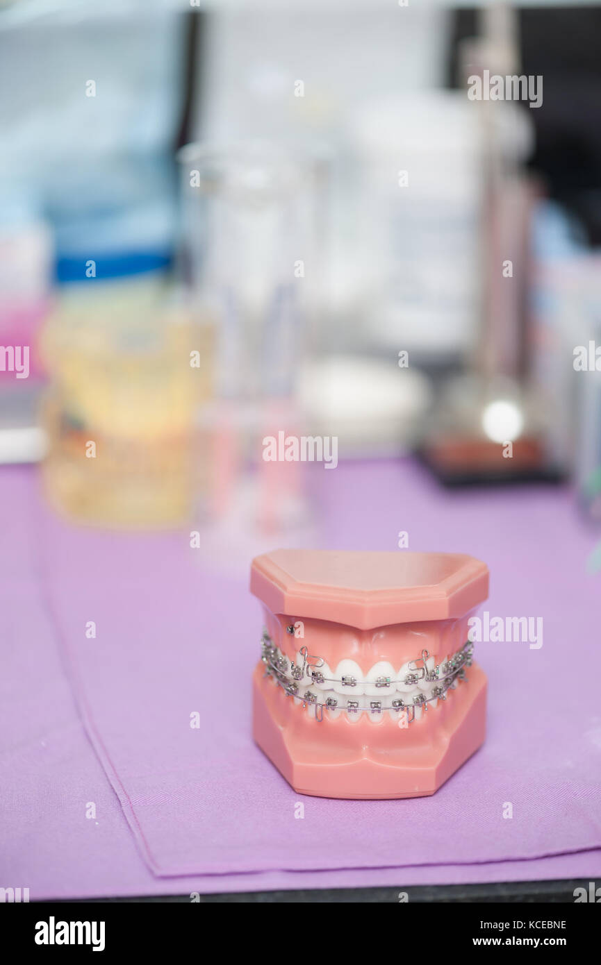 Odontoiatrici strumenti campione in uso clinico per ortodonzia problemi. per le cure dentarie e concetto di trattamento Foto Stock