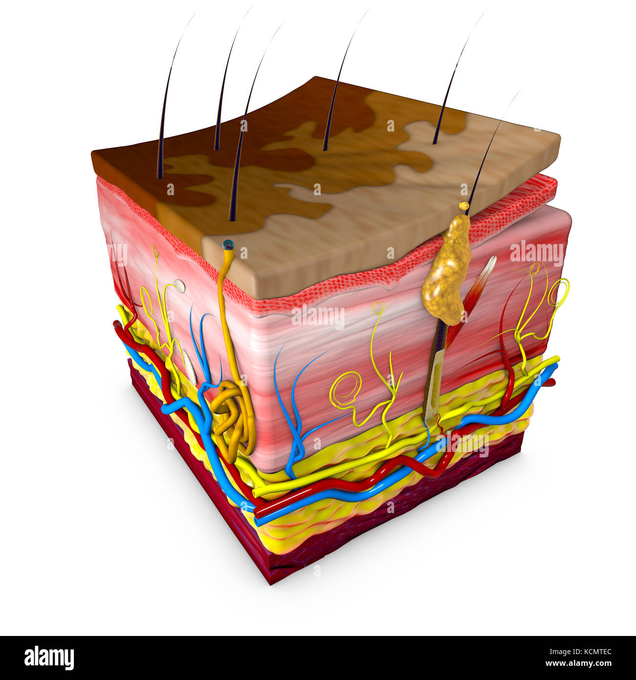 Tigna versicolor è una condizione caratterizzata da una eruzione cutanea sul tronco ed estremità prossimali. sezione della pelle. il rendering in 3D Foto Stock