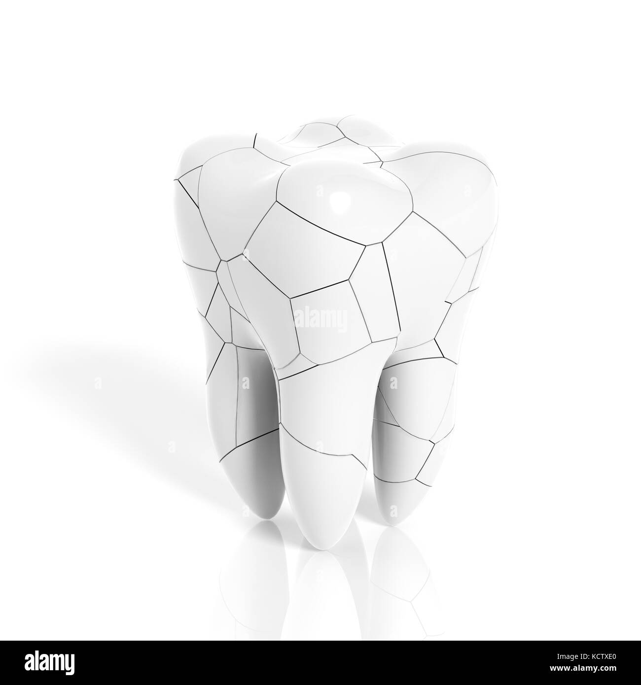 Rotto il dente molare isolato su sfondo bianco Foto Stock