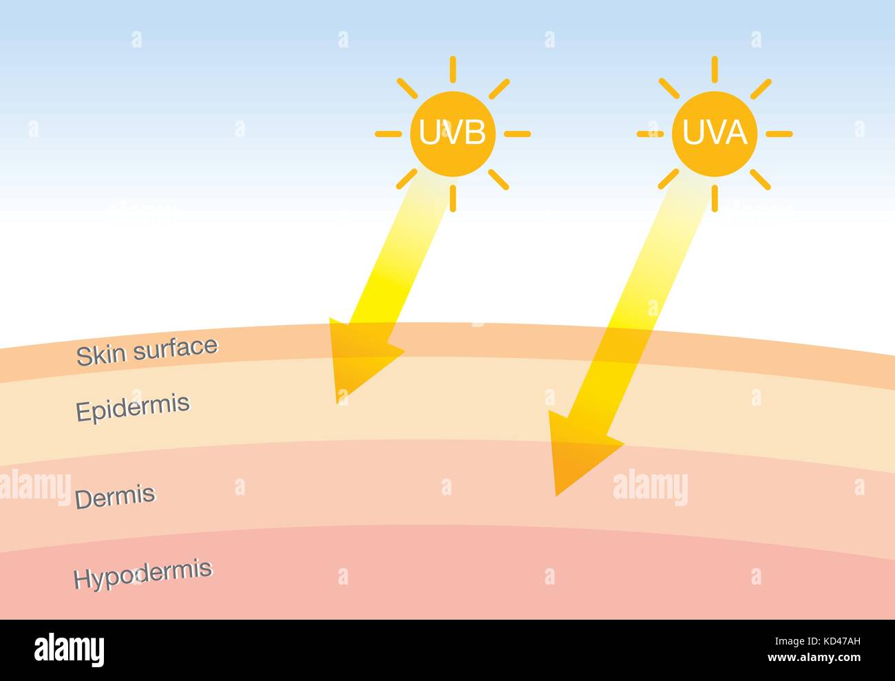 La differenza di radiazione 2 tipi nella luce del sole con la pelle. Illustrazione Vettoriale