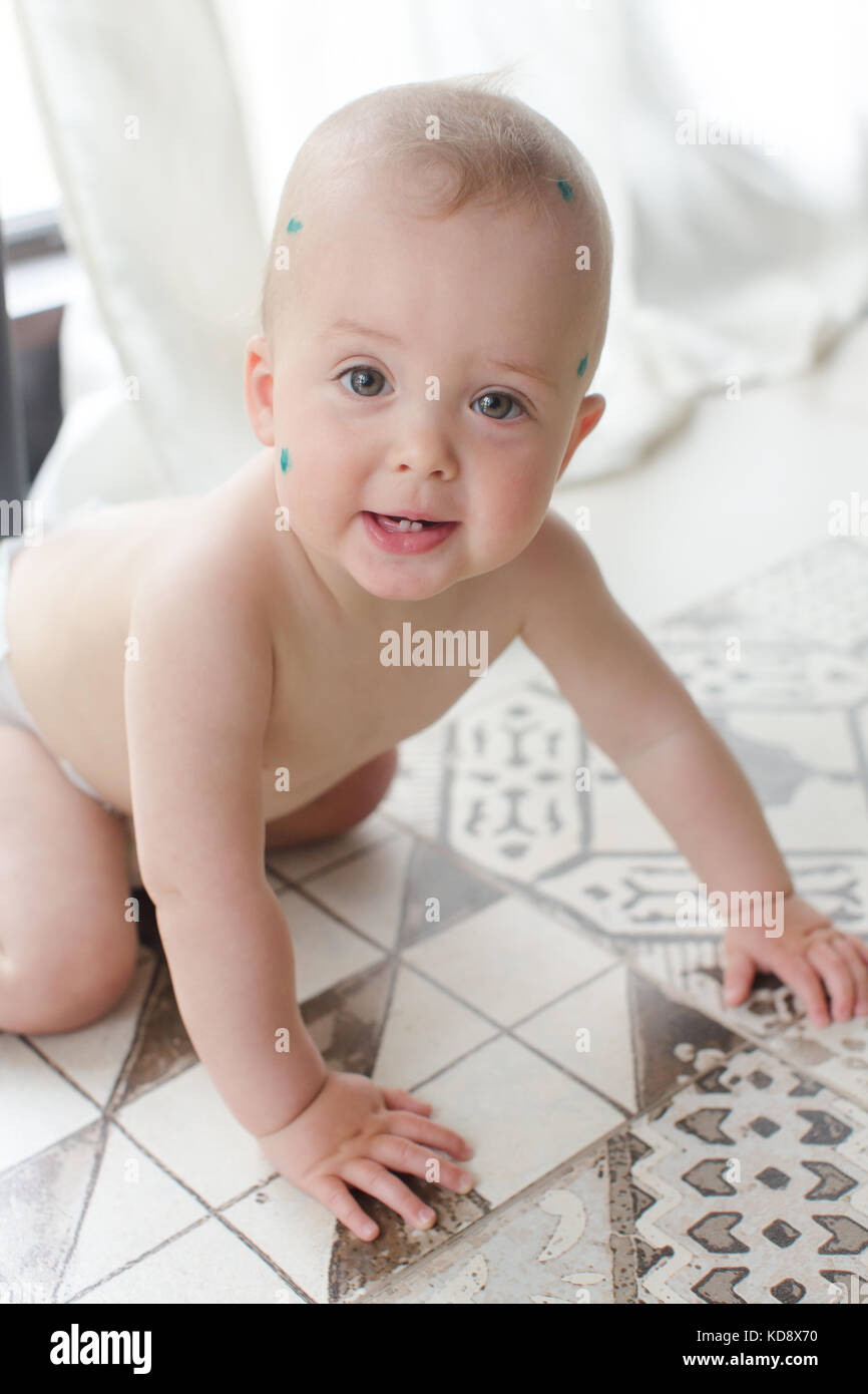 Bambino con la varicella sul pavimento su sfondo bianco Foto Stock