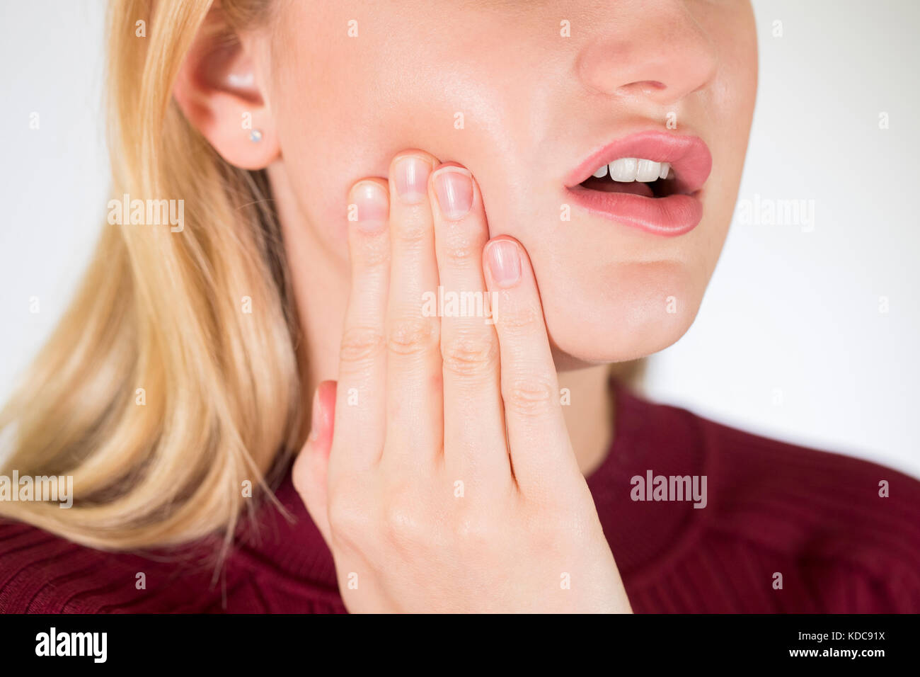 Studio ravvicinata di una donna che soffriva di mal di denti Foto Stock