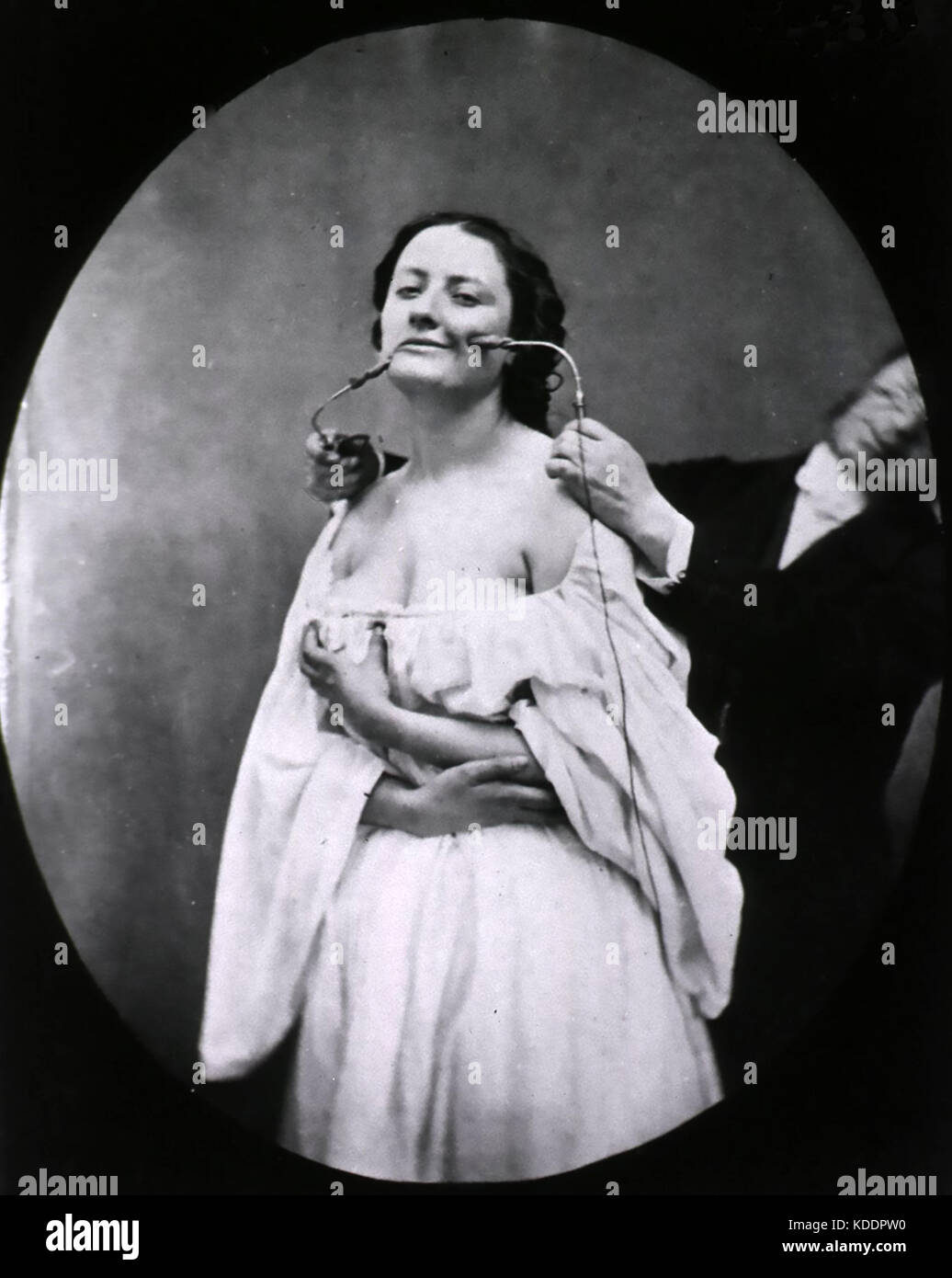 Duchenne de BOULOGNE (1806-1875) neurologo francese che applica elettrodi per stimolare i muscoli del viso dal suo libro del 1862 "ecanisme de la physionomie humaine" Foto Stock