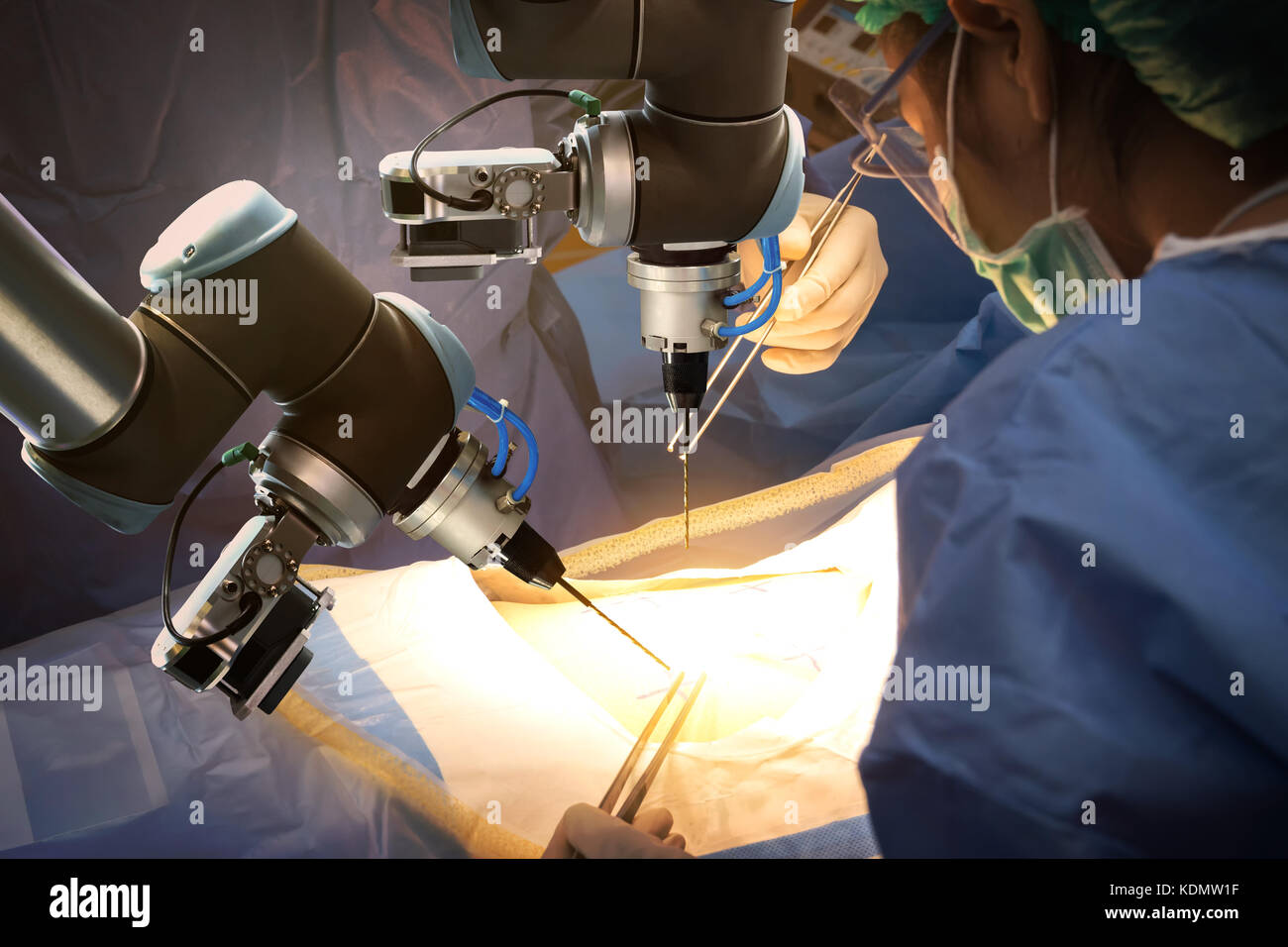 Smart precision healthcare , tecnologia di intelligenza artificiale concetto. Robot di automazione della macchina a mano in sala operatoria e chirurgia medici in futuri Foto Stock