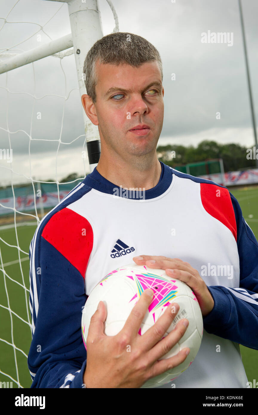 Paralimpico calciatore cieco dave Clarke. Foto Stock